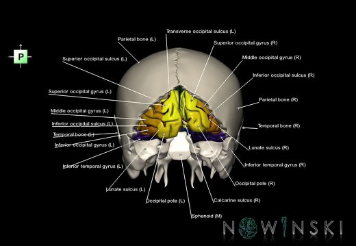 G8.T3.1-22.2 22.5.6.V3.C4-2.L1.Cerebrum-Neurocranium-No occipital bone