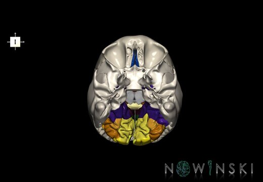 G8.T3.1-22.2 22.5.6.V6.C3-2.L0.Cerebrum-Neurocranium-No occipital bone