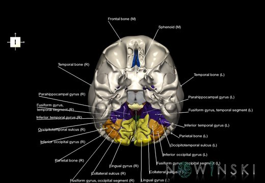 G8.T3.1-22.2 22.5.6.V6.C4-2.L1.Cerebrum-Neurocranium-No occipital bone