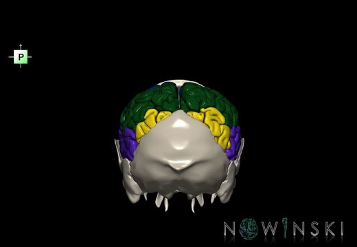 G8.T3.1-22.2 22.5.8.V3.C2.L0.Cerebrum-Neurocranium-No parietal bone