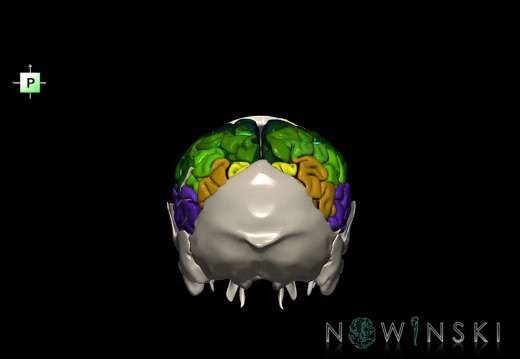 G8.T3.1-22.2 22.5.8.V3.C4-2.L0.Cerebrum-Neurocranium-No parietal bone