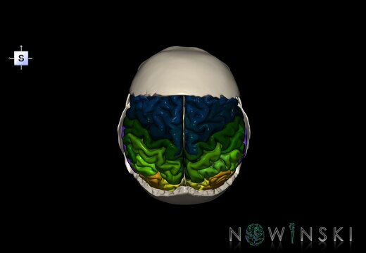 G8.T3.1-22.2 22.5.8.V5.C3-2.L0.Cerebrum-Neurocranium-No parietal bone