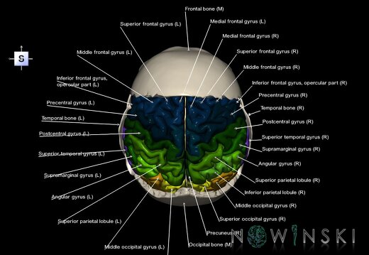 G8.T3.1-22.2 22.5.8.V5.C3-2.L1.Cerebrum-Neurocranium-No parietal bone