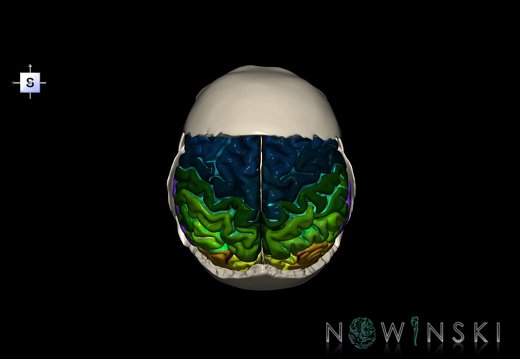 G8.T3.1-22.2 22.5.8.V5.C4-2.L0.Cerebrum-Neurocranium-No parietal bone