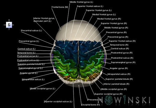 G8.T3.1-22.2 22.5.8.V5.C4-2.L1.Cerebrum-Neurocranium-No parietal bone