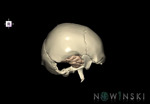 G8.T3.1-22.2 22.5.9.V4.C1.L0.Cerebrum-Neurocranium-No temporal bone