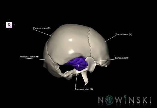 G8.T3.1-22.2 22.5.9.V4.C2.L1.Cerebrum-Neurocranium-No temporal bone