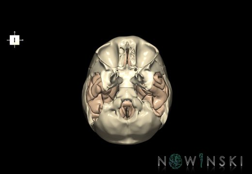 G8.T3.1-22.2 22.5.9.V6.C1.L0.Cerebrum-Neurocranium-No temporal bone