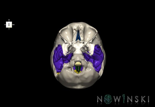G8.T3.1-22.2 22.5.9.V6.C2.L0.Cerebrum-Neurocranium-No temporal bone