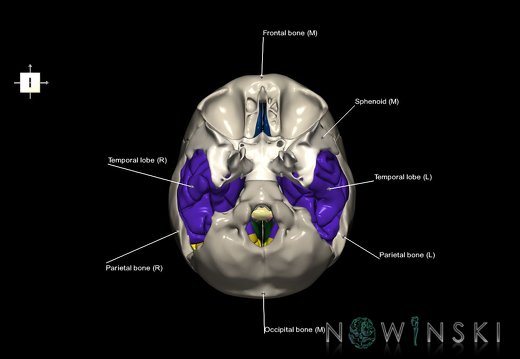 G8.T3.1-22.2 22.5.9.V6.C2.L1.Cerebrum-Neurocranium-No temporal bone