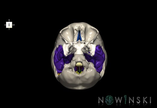 G8.T3.1-22.2 22.5.9.V6.C3-2.L0.Cerebrum-Neurocranium-No temporal bone