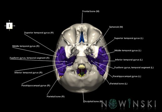 G8.T3.1-22.2 22.5.9.V6.C3-2.L1.Cerebrum-Neurocranium-No temporal bone