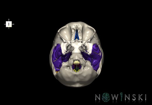 G8.T3.1-22.2 22.5.9.V6.C4-2.L0.Cerebrum-Neurocranium-No temporal bone