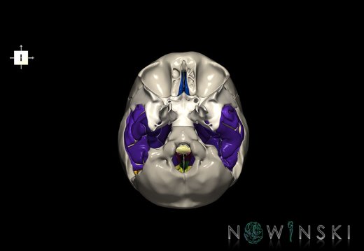 G8.T3.1-22.2 22.5.9.V6.C4-2.L0.Cerebrum-Neurocranium-No temporal bone