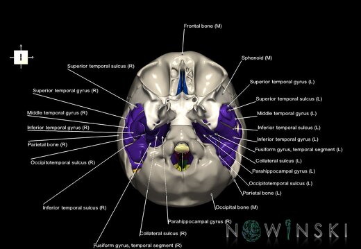 G8.T3.1-22.2 22.5.9.V6.C4-2.L1.Cerebrum-Neurocranium-No temporal bone