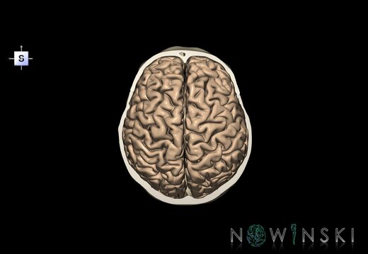 G8.T3.1-22.2 22.6.V5.C1.L0.Cerebrum-Neurocranium-No skull top
