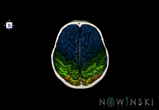 G8.T3.1-22.2 22.6.V5.C3-2.L0.Cerebrum-Neurocranium-No skull top