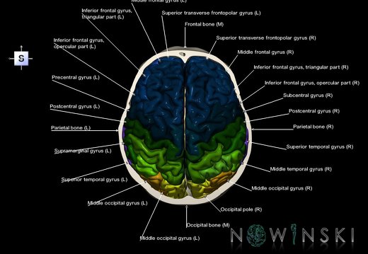 G8.T3.1-22.2 22.6.V5.C3-2.L1.Cerebrum-Neurocranium-No skull top
