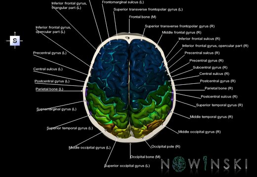 G8.T3.1-22.2 22.6.V5.C4-2.L1.Cerebrum-Neurocranium-No skull top