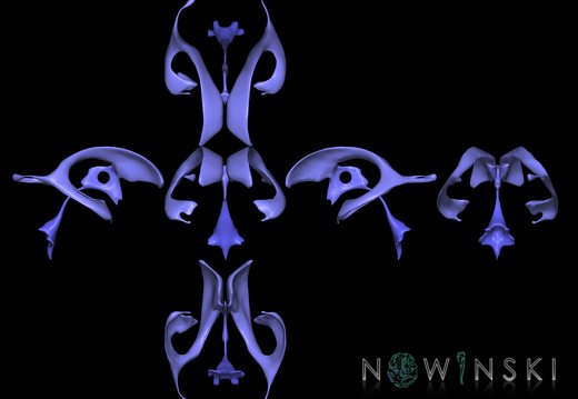 G9T12.SixViewCerebralVentricles