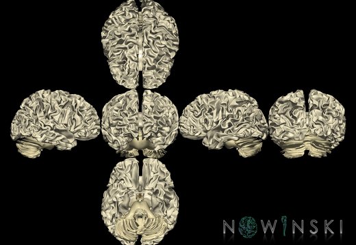 G9T13.1.SixViewWhiteMatter