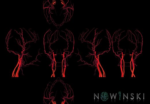 G9T17.2.SixViewExtracranialArteries