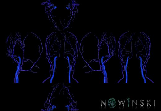 G9T18.2.SixViewExtracranialVeins