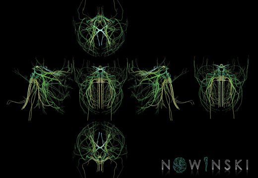 G9T19.1.SixViewCranialNerves-Nuclei