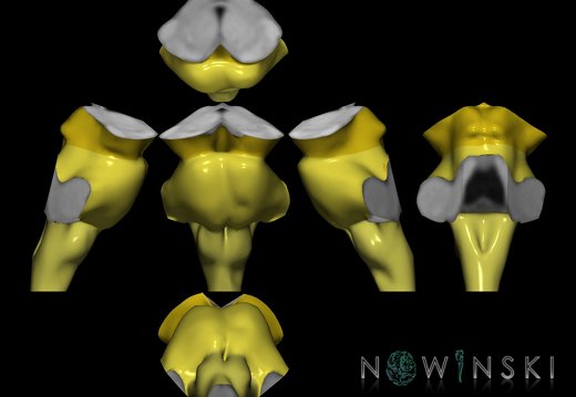 G9T9.SixViewBrainstem