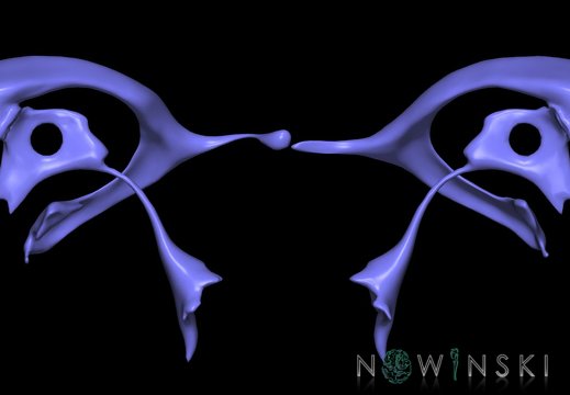 G9T12.TwoViewCerebralVentricles