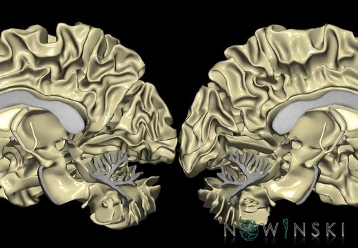 G9T13.2-13.3.TwoViewWhiteMatter