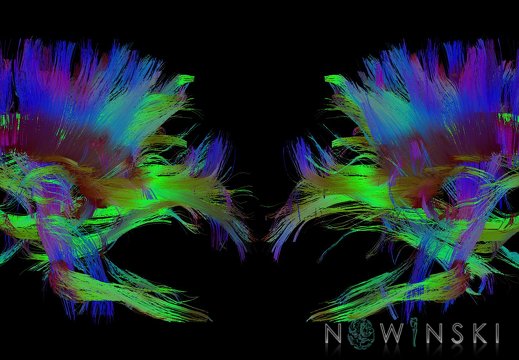 G9T14.TwoViewWhiteMatterTracts