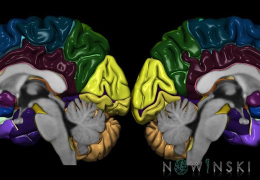 G9T2.2-2.3.TwoViewBrain