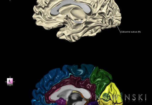 G9.T7.1.DualImageSulci.Calcarine sulcus right