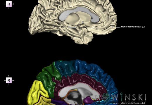 G9.T7.10.DualImageSulci.Inferior rostral sulcus left
