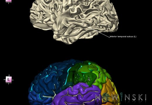 G9.T7.11.DualImageSulci.Inferior temporal sulcus left