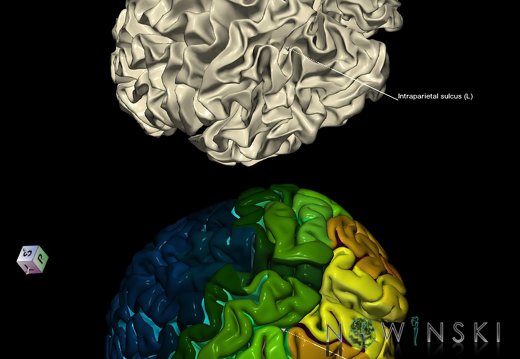 G9.T7.12.DualImageSulci.Intraparietal sulcus left