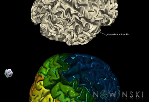 G9.T7.12.DualImageSulci.Intraparietal sulcus right