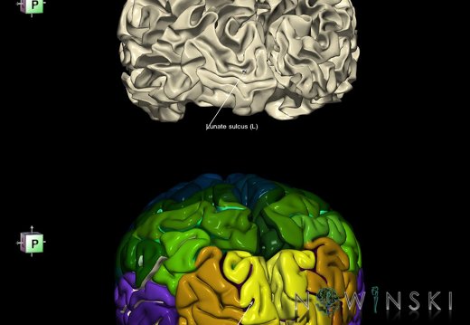 G9.T7.13.DualImageSulci.Lunate sulcus left