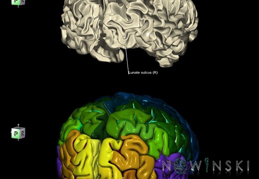 G9.T7.13.DualImageSulci.Lunate sulcus right