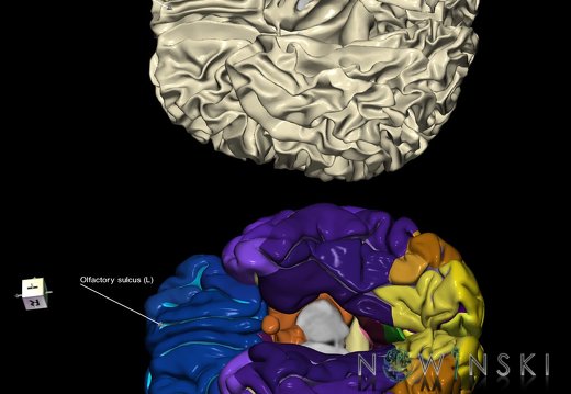 G9.T7.15.DualImageSulci.Olfactory sulcus left