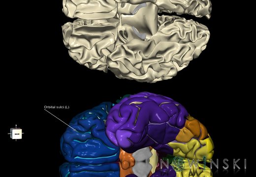 G9.T7.16.DualImageSulci.Orbital sulci left