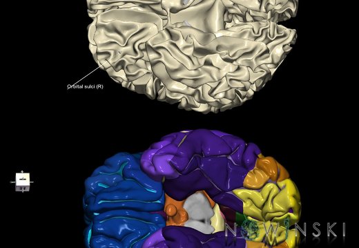 G9.T7.16.DualImageSulci.Orbital sulci right