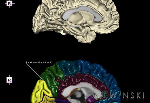 G9.T7.17.DualImageSulci.Parieto-occipital sulcus left