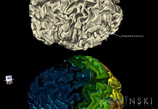 G9.T7.18.DualImageSulci.Postcentral sulcus left