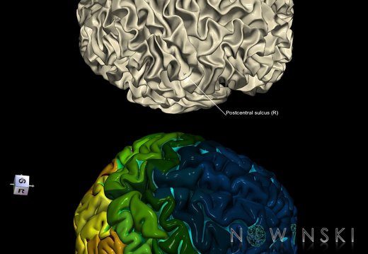 G9.T7.18.DualImageSulci.Postcentral sulcus right