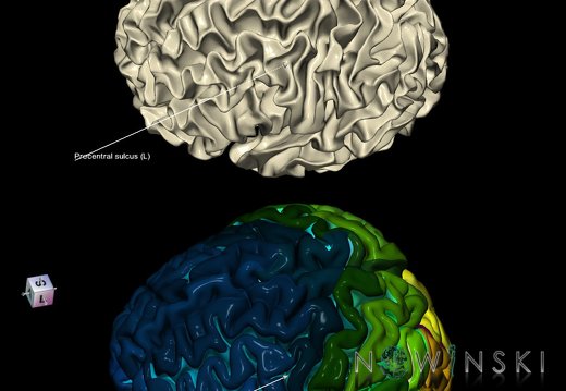 G9.T7.19.DualImageSulci.Precentral sulcus left