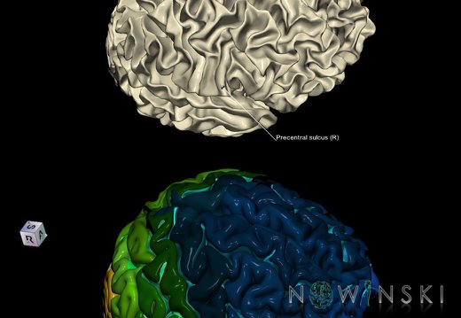 G9.T7.19.DualImageSulci.Precentral sulcus right