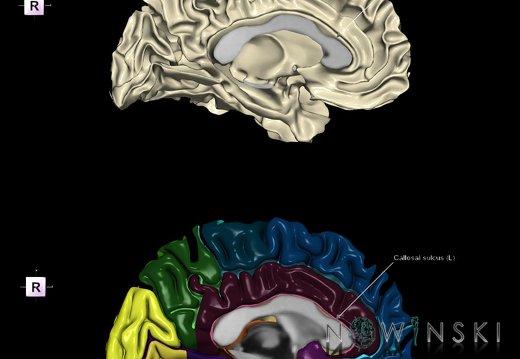 G9.T7.2.DualImageSulci.Callosal sulcus left