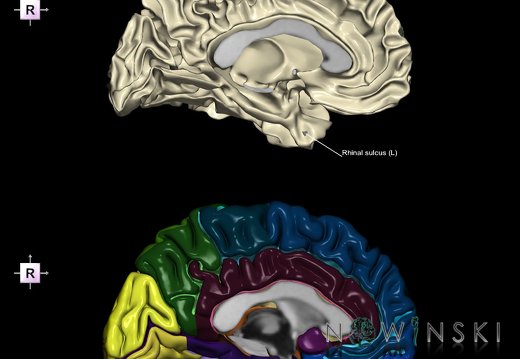 G9.T7.20.DualImageSulci.Rhinal sulcus left